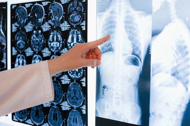 doctors looking at body scans